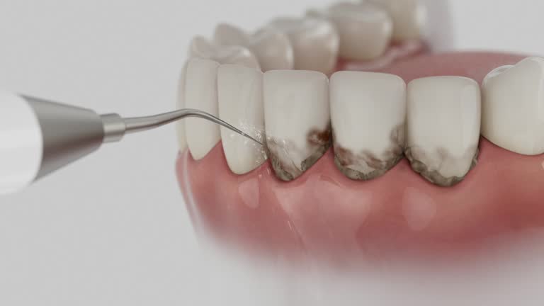 Reliable Dental contractor in Islamorada Village of Islands, FL by Dentist Open Now